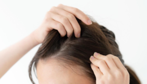 頭皮の赤みは放置すると抜け毛やかゆみを引き起こす 原因と対策について 女性の薄毛 抜け毛予防なら 髪のせんせいwomen Byスカルプdのアンファー